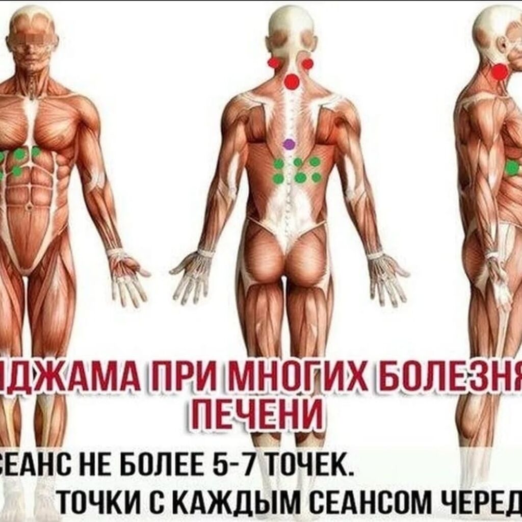 Хиджама что это