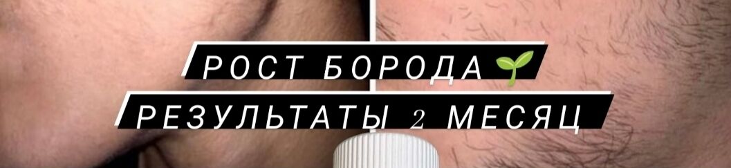 Сакал чач остуруу кам көрүү ➤ Кыргызстан ᐉ Бизнес-профиль компании на lalafo.kg