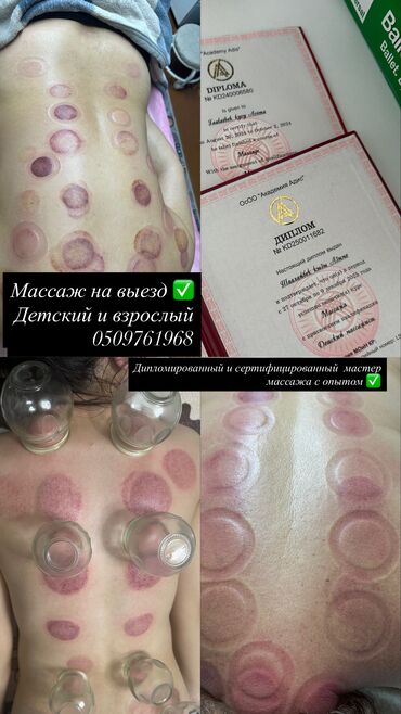 Массаж: Массаж | Спортивный массаж | Защемление седалищного нерва, Кифос, лордоз, Межпозвоночная грыжа | С выездом на дом — 1