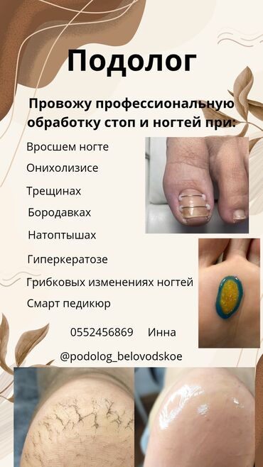Маникюр, педикюр: Коррекция вросших ногтей, Услуги подолога, Одноразовые расходные материалы