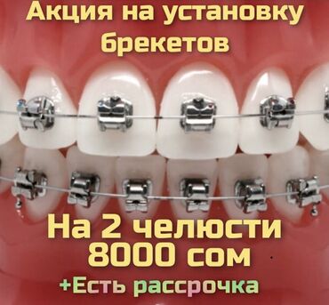 поддоны бишкек in Кыргызстан | АВТОЗАПЧАСТИ: Стоматолог | Протезирование, Удаление, Фотопломбы | Консультация