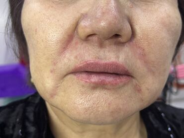 Косметика: Процедура перманентного макияжа губ позволяет придать губам желаемый — 26