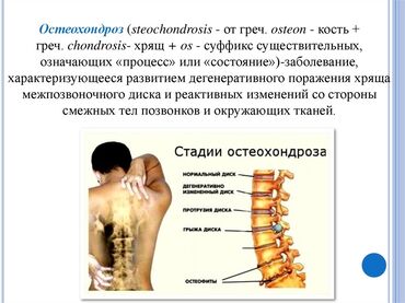 Уход за телом: Бишофит от чего помогает. опорно-двигательного аппарата — 9