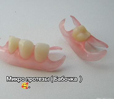брекеты зубы: Клиника | Стоматолог | Протезирование — 9