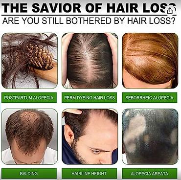 Уход за телом: США Сыворотка от облысения очень эффективная листаем фото спрей — 2