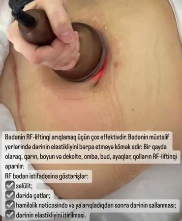 Masaj: Müalicəvi masaj, Uşaqlar üçün, Kişilər üçün, Qadınlar üçün, Klinikada -da lalafo.az — 4 Masaj: Müalicəvi masaj, Uşaqlar üçün, Kişilər üçün, Qadınlar üçün, Klinikada — 4