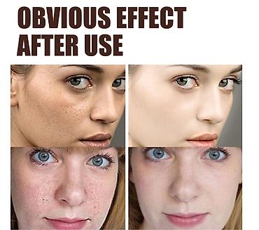 третиноин крем: ❄️ США с Аmazon Walmart и Fruugо Антивозрастной Омолаживающий Retinol — 7