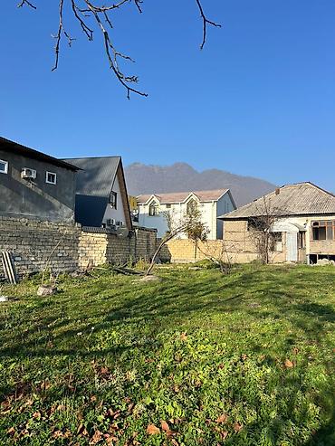 sans tibb merkezi gence: 11 sot, Tikinti, Kupça (Çıxarış) — 3