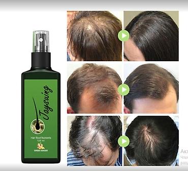 Уход за телом: США Сыворотка от облысения очень эффективная листаем фото спрей — 10