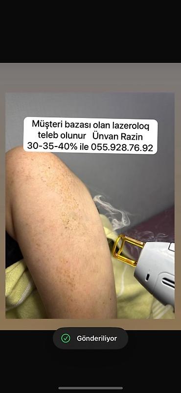 operator teleb olunur: Lazer ustası tələb olunur, Faiz — 1