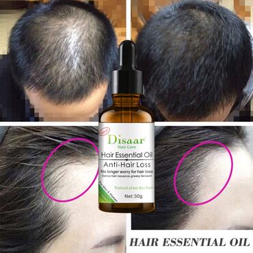 Уход за телом: Масло-активатор роста волос с имбирем Disaar Hair Essence Oil 30мл