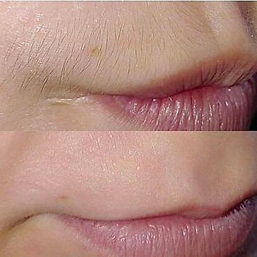 Эпиляция: Восковая депиляция для женщин и мужчин Подмышки - 500 сом — 8