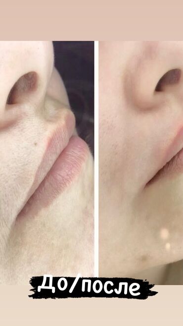 Эпиляция: Город Ош Шугаринг Ош 🔥 Ваксинг Ош 🔥 Всех зон 🔥 Все материалы — 8