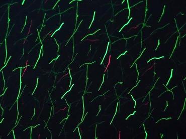 Baštenska rasveta: BabySbreath Laser Light – spoljašnji/unutrašnji laserski projektor za — 8