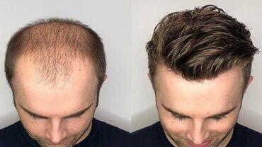 Saçlara qulluq: Saç düzümü üçün vasitələr, Yeni, Pulsuz çatdırılma