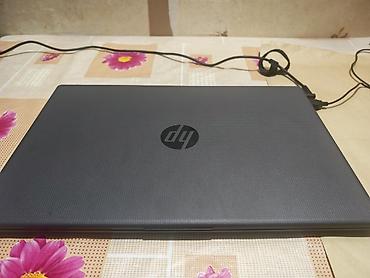 HP: HER SEY İDEALDİR ! BİRCE KAROPKASİN ATİBLAR BİLMEDEN BASGA HER SEY — 4