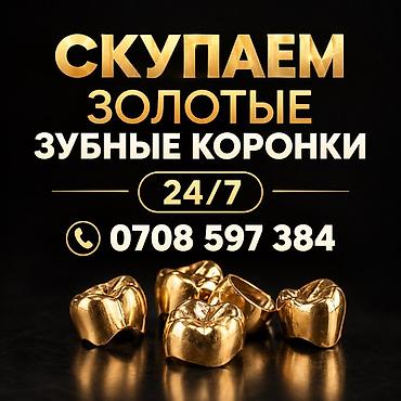 зубные: Сервис скупки золотых зубных коронок. Принимаем изделия из золота — 1