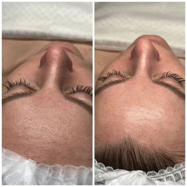 Косметология: Косметология, Пилинг, Ботулинотерапия, Плазмолифтинг, Консультация, Требуются модели, Сертифицированный косметолог — 8