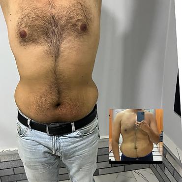 mega express: Arıqlama masajı, Kişilər üçün, Klinikada — 4
