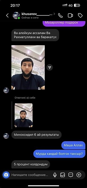 щеки: Миноксидил 5% для роста бороды + массажный дермароллер (указан как — 3