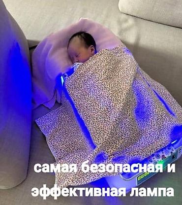 Медицинские лампы: Фотолампа от желтушки, желтухи билирубин .Особенности и преимущества — 2