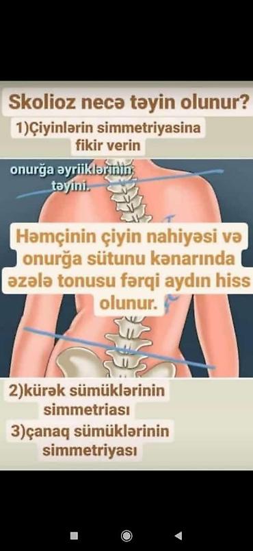masaj bakü: Skolioz masajı, Uşaqlar üçün — 2