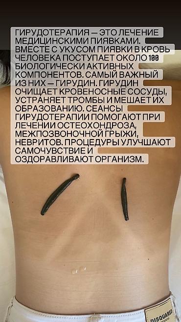 простатит: Врачи, Клиника | Гирудотерапевт | Диагностика, Консультация, Лечение пиявками — 7