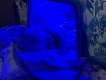 лампа для лечения желтухи новорожденных: Эффективная Ультрафиолет лампа от желтухи для детей. Лечение желтухи