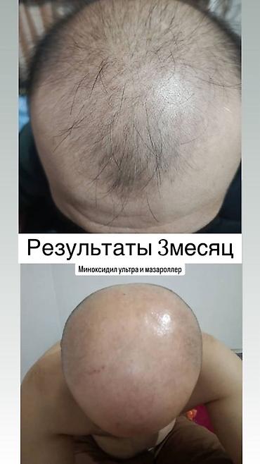 етор: Сыворотка для роста волос и бороды REAXIDIL 10% Minoxidil, 50 мл - — 4