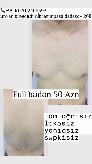 Digər gözəllik və sağlamlıq xidmətləri: Kişilər üçün Lazer Epilasiya✅ Üz,Boyun,Boğaz,Qulaq,Burun = 10 AZN — 4