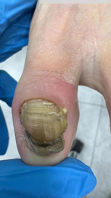 Маникюр: Коррекция вросших ногтей, Маникюр, Педикюр, Услуги подолога, С выездом на дом, Консультация, Одноразовые расходные материалы — 18