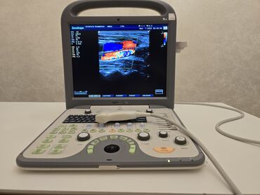 Tibbi avadanlıq: SONOSCAPE S8 linear datçiklə