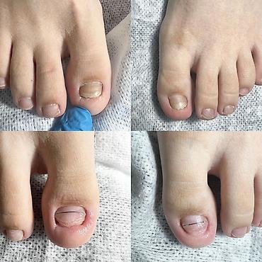 Маникюр: Маникюр • Педикюр • Подология Профессиональный уход за руками и — 1