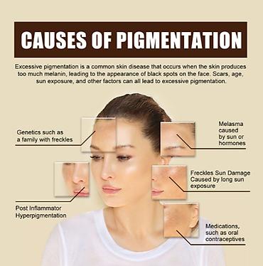 Уход за телом: США Крем интенсивное отбеливание удаление темных пятен веснушек и — 12