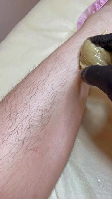 Эпиляция: Шугаринг (депиляция сахарной пастой) Зоны: - Подмышки - Ноги (голени) — 5