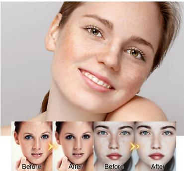 Уход за телом: США Крем интенсивное отбеливание удаление темных пятен веснушек и — 9