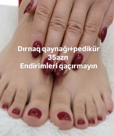 акция на установку брекетов: Pedikür, Dırnaq qaynağı