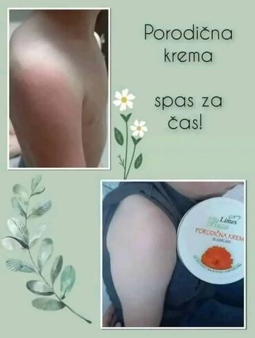 Nega kože: Svakoj porodici je potrebna jedna porodicna krema😊 Melem za gde god — 4