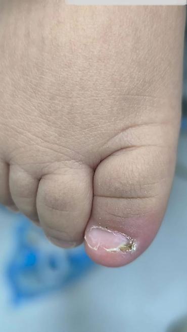 Маникюр: Коррекция вросших ногтей, Маникюр, Педикюр, Услуги подолога, С выездом на дом, Консультация, Одноразовые расходные материалы — 5