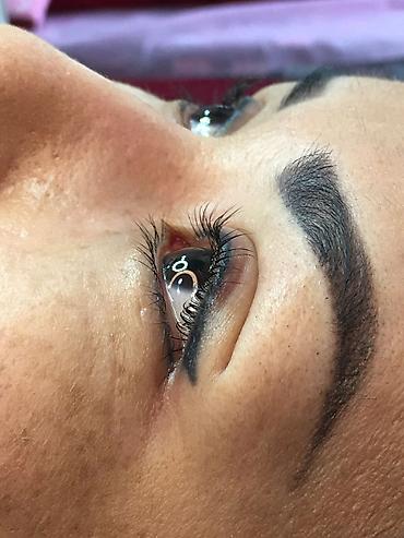 Косметология: Косметология, Ботокс, Биоревитализация, Ботулинотерапия, Консультация, Гипоаллергенные материалы, Сертифицированный косметолог — 9