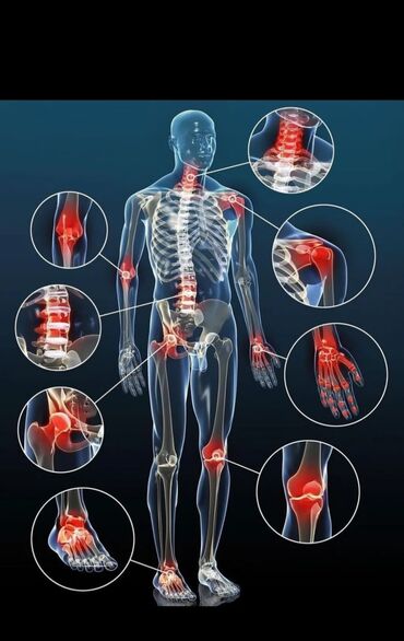 Массаж: Массаж | Лечебный массаж | Сутулость, нарушение осанки, Остеохондроз, Смещение позвонков | Консультация — 4