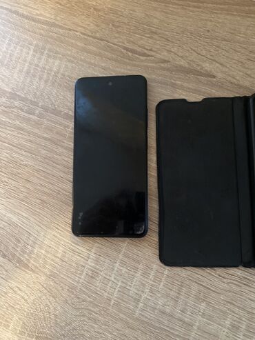 Teze telefondur hec pireblemi yoxdu