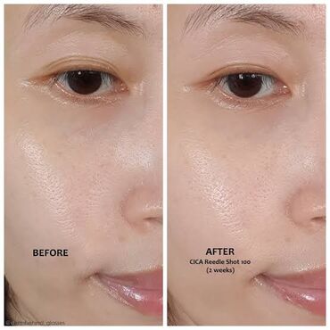 Косметика: 🔥 НАБОР (2шт сыворотки и увлажняющий крем)Reedle Shot Duo Set — — 3