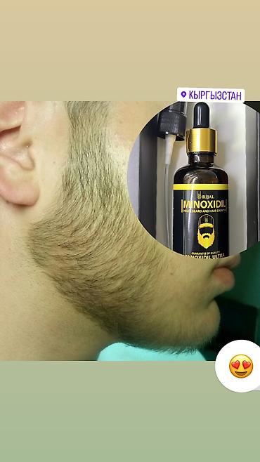 Уход за телом: Миноксидил ультра 15% 100мл 3 месяц хватает Для бороды и волосы — 11