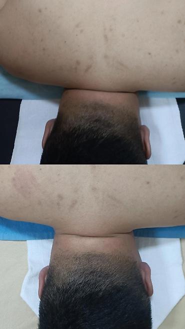 Курсы массажа: Курсы массажа | Классический массаж, Лечебный массаж, Вакуумный массаж — 7