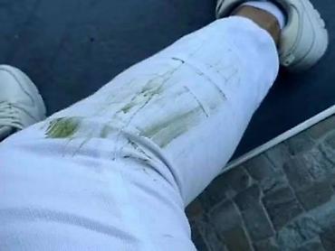 Ortopedski dušeci i jastuci: Limes proizvodi Porudzbine,saradnja postani moj kupac,saradnik — 185