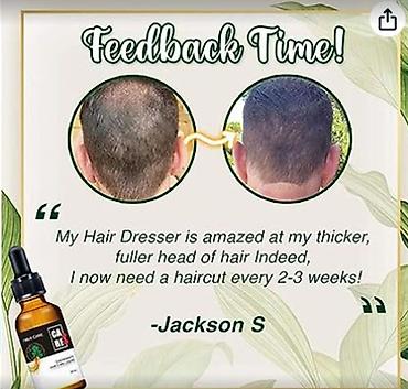 Уход за телом: США средство от облысения от выпадения волос для роста волос будит — 9