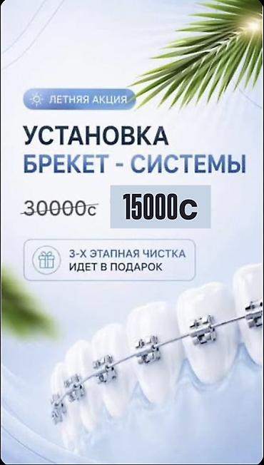 установка брекет: Услуга: установка брекет‑системы на обе челюсти. - Акция: стоимость — 3