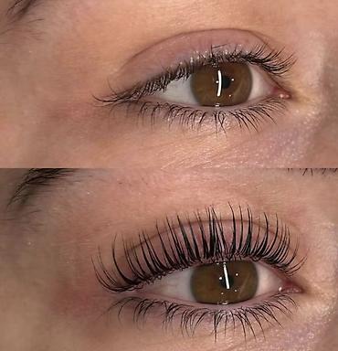 Kiprik laminasiyasi botox boya endirimde 30yox 20m✨✨✨Tam orginal lalafo.az -da Kiprik laminasiyasi botox boya endirimde 30yox 20m✨✨✨Tam orginal
