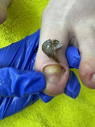 Маникюр: Коррекция вросших ногтей, Услуги подолога, Маникюр, Педикюр, Услуга в 4 руки, Одноразовые расходные материалы, Консультация — 11